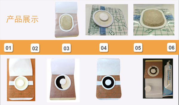 瓊森穴位貼敷治療貼 4貼裝1.jpg