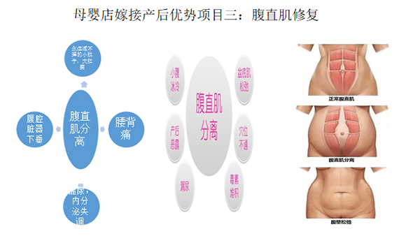 少林永化堂產(chǎn)后項目-腹直肌修復