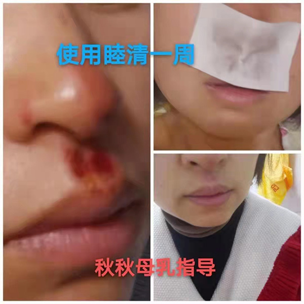 澏NÆM߿ڱa(chn)ƷȦ۟o(sh)